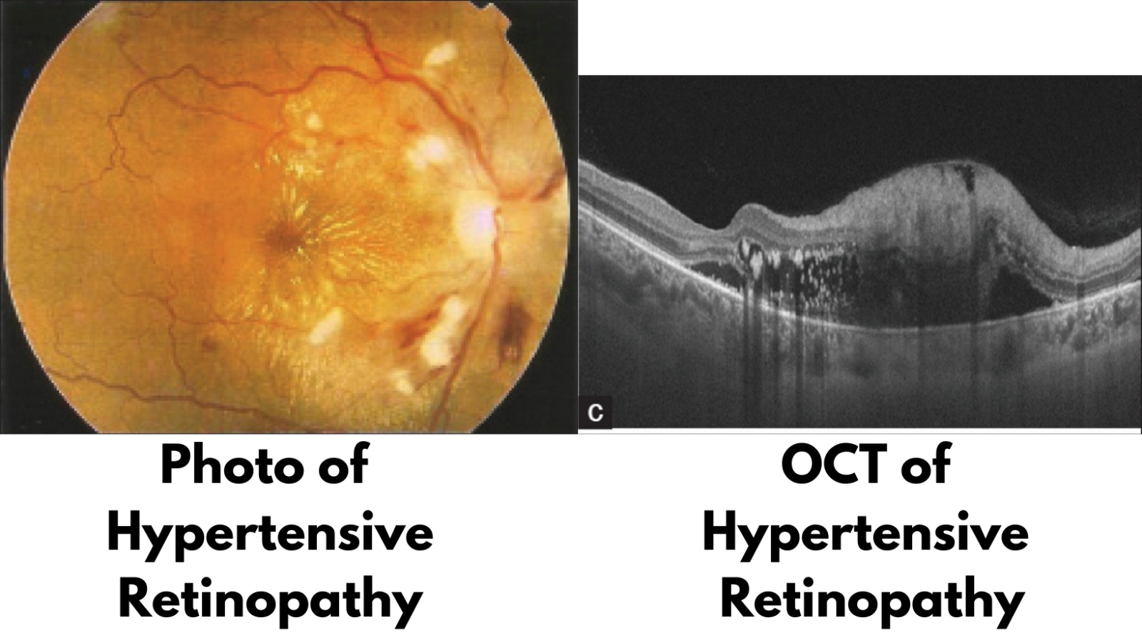 Why Get Wellness Photos (Retinal Photo and OCT)? | theeyeshopaz.com